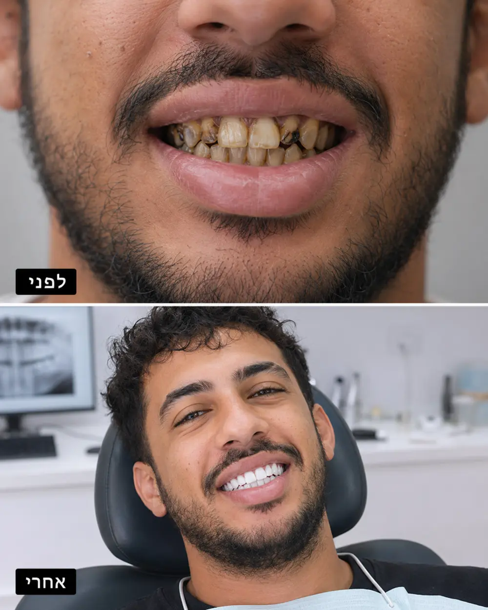 תמונת לפני ואחרי